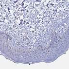Immunohistochemical staining of human skin shows no positivity in squamous epithelial cells as expected.
