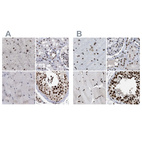 Immunohistochemical staining of human cerebral cortex, kidney, skeletal muscle and testis using Anti-SCAF4 antibody HPA021504 (A) shows similar protein distribution across tissues to independent antibody HPA018319 (B).