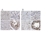 Immunohistochemical staining of human cerebral cortex, kidney, skeletal muscle and testis using Anti-SCAF4 antibody HPA021504 (A) shows similar protein distribution across tissues to independent antibody HPA018319 (B).