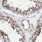 Immunohistochemical staining of human testis shows high expression.