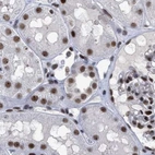 Immunohistochemical staining of human kidney using Anti-SCAF4 antibody HPA021504.