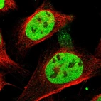 Immunofluorescent staining of human cell line U-2 OS shows localization to nucleoplasm.