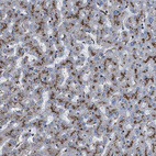 Immunohistochemical staining of human liver shows moderate granular cytoplasmic positivity in hepatocytes.