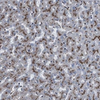 Immunohistochemical staining of human liver shows moderate granular cytoplasmic positivity in hepatocytes.
