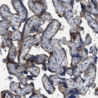 Immunohistochemical staining of human placenta shows moderate granular cytoplasmic positivity in trophoblastic cells.