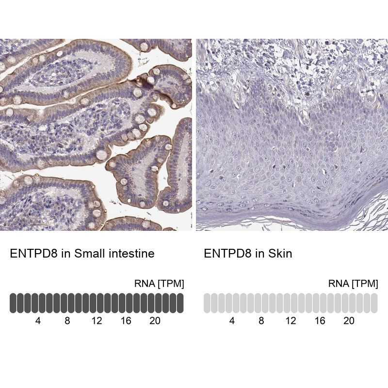 Anti-ENTPD8 Antibody