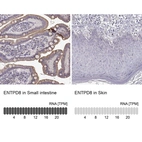 Anti-ENTPD8 Antibody