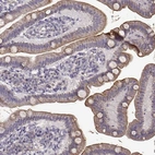 Immunohistochemical staining of human small intestine shows strong membranous positivity in glandular cells.