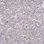 Immunohistochemical staining of human liver shows moderate membranous positivity in hepatocytes.