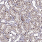 Immunohistochemical staining of human kidney shows moderate cytoplasmic positivity in cells in tubules.