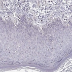 Immunohistochemical staining of human skin shows no positivity in squamous epithelial cells as expected.