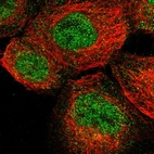 Immunofluorescent staining of human cell line A-431 shows localization to nucleoplasm & cytosol.