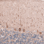 Immunohistochemical staining of human cerebellum shows moderate cytoplasmic positivity in Purkinje cells.