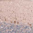 Immunohistochemical staining of human cerebellum shows moderate cytoplasmic positivity in Purkinje cells.