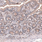 Immunohistochemical staining of human duodenum shows moderate cytoplasmic positivity in glandular cells.