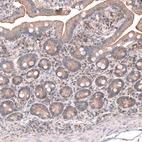 Immunohistochemical staining of human duodenum shows moderate cytoplasmic positivity in glandular cells.