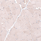 Immunohistochemical staining of human skeletal muscle shows no positivity in striated muscle fibers as expected.