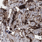 Immunohistochemical staining of human placenta shows strong nuclear membrane positivity in trophoblastic cells.
