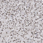 Immunohistochemical staining of human liver shows strong nuclear membrane positivity in hepatocytes.