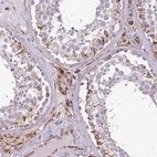 Anti-ZNF786 Antibody