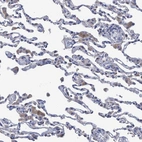 Anti-SVEP1 Antibody