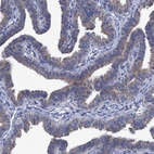 Immunohistochemical staining of human fallopian tube shows weak cytoplasmic positivity in glandular cells.