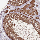 Immunohistochemical staining of human testis shows strong nuclear and cytoplasmic positivity in cells in seminiferous ducts and Leydig cells.