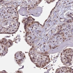 Immunohistochemical staining of human placenta shows moderate nuclear positivity in trophoblastic cells.