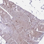 Immunohistochemical staining of human skeletal muscle shows strong nuclear positivity in myocytes.
