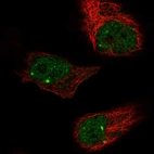 Immunofluorescent staining of human cell line HeLa shows localization to nucleoplasm & nuclear bodies.