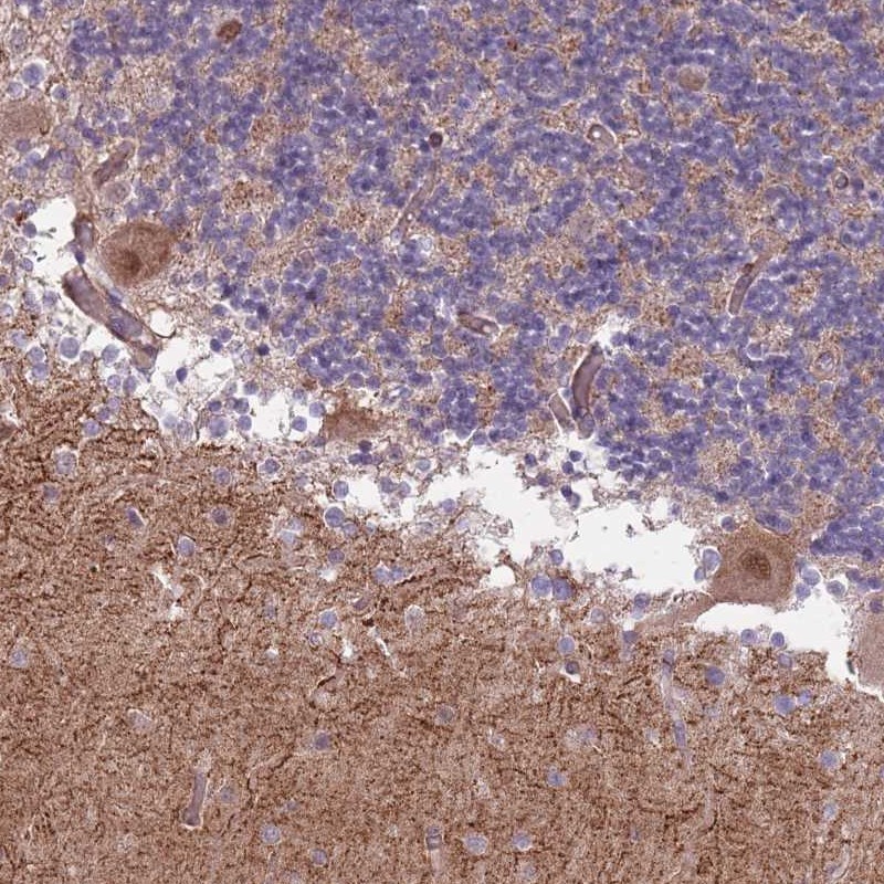 Anti-CREBZF Antibody