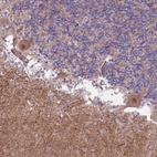 Anti-CREBZF Antibody