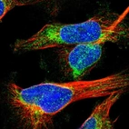 Immunofluorescent staining of human cell line U-251 MG shows localization to nuclear membrane & cytosol.
