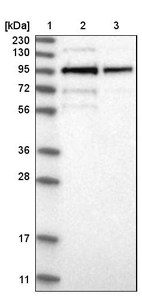 Lane 1: Marker [kDa] 230, 130, 95, 72, 56, 36, 28, 17, 11_br/_Lane 2: Human cell line RT-4_br/_Lane 3: Human cell line U-251MG sp