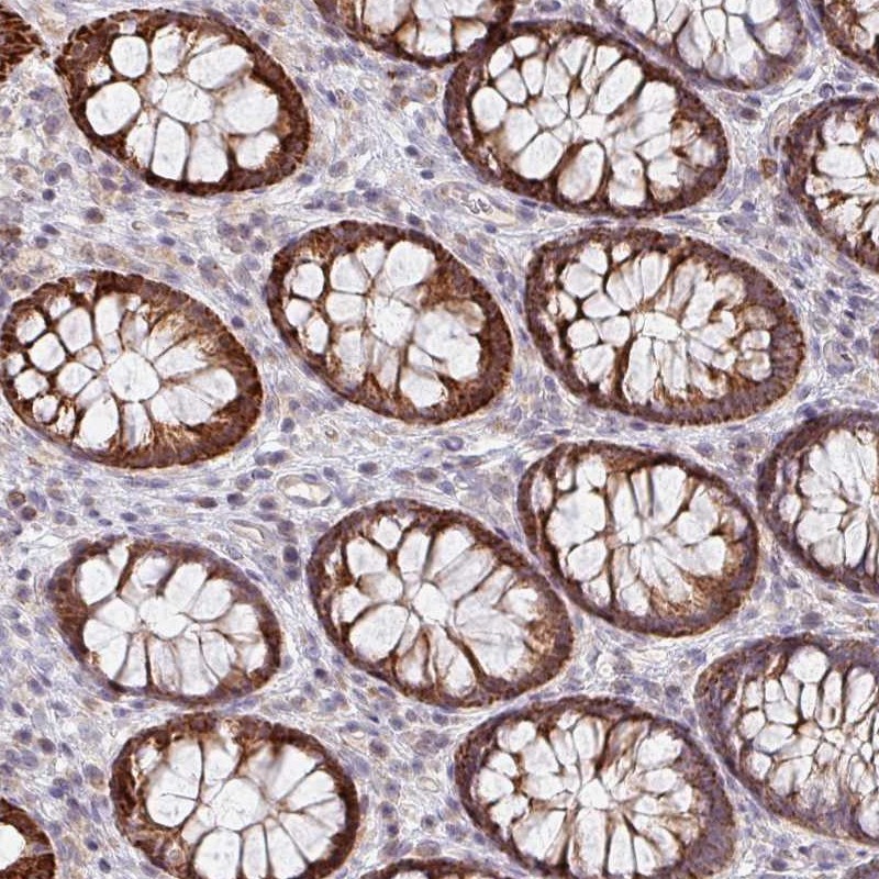 Anti-ZNF791 Antibody
