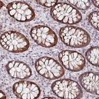 Anti-ZNF791 Antibody