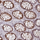 Anti-ZNF791 Antibody