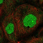 Immunofluorescent staining of human cell line A-431 shows localization to nucleus.