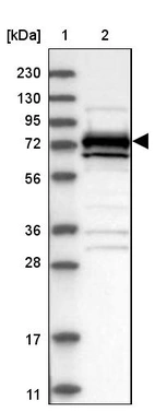 Lane 1: Marker [kDa] 230, 130, 95, 72, 56, 36, 28, 17, 11_br/_Lane 2: Human cell line RT-4