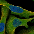 Immunofluorescent staining of human cell line U-2 OS shows localization to nucleoplasm & cytosol.