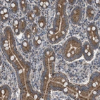 Anti-TPK1 Antibody