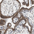Immunohistochemical staining of human placenta shows strong cytoplasmic positivity in trophoblastic cells.
