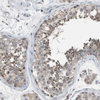 Immunohistochemical staining of human testis shows moderate cytoplasmic positivity in cells in seminiferous ducts.
