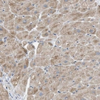 Immunohistochemical staining of human heart muscle shows moderate cytoplasmic positivity in myocytes.