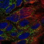 Immunofluorescent staining of human cell line CACO-2 shows localization to vesicles.
