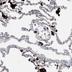 Anti-PPT1 Antibody