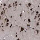 Immunohistochemical staining of human cerebral cortex shows very strong granular positivity in cytoplasm in neurons.