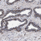 Immunohistochemical staining of human prostate shows strong granular positivity in cytoplasm in glandular cells.