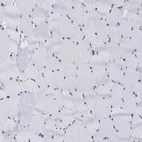 Immunohistochemical staining of human skeletal muscle shows no positivity in myocytes as expected.