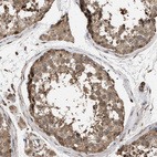 Anti-NAA35 Antibody